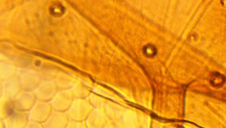 mosquito under microscope