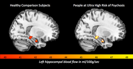 psychosis---in-article