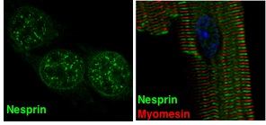 Nesprin