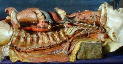 Example of the anatomical modelling of Joseph Townes showing the spine and organs of the lying figure