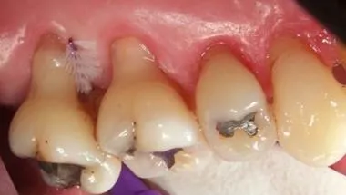 periodontal medicine