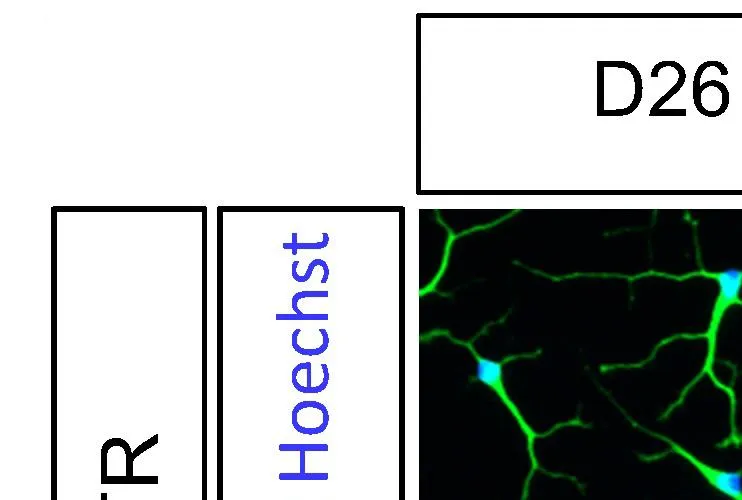 Interferon gamma treatment of neural progenitor cells (NPCs) leads to enhanced neurite outgrowth in post-mitotic neurons