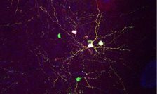 New Research Led by King's and the Crick Reveals How Brains Develop the Correct Mix of Cells