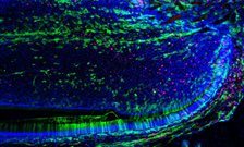 Study finds how to activate stem cell growth from reserves