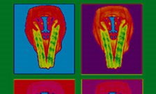 Dental Institute celebrates 20 years of craniofacial development