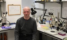 My Life with Treacher Collins Syndrome and its connection to my research
