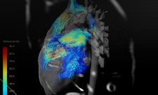 King's scientists shine in heart research competition