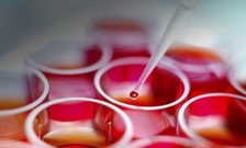 KCL Researchers get £1.6 million grant to make healthcare mobile