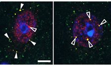 Study reveals new mechanisms of cell death in neurodegenerative disorders