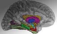 Premature birth linked to older 'brain age' in adult life