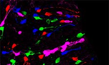 Study reveals new insights into early stages of brain development
