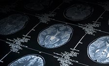 The UK's leading mental health experts unite to solve treatment challenges