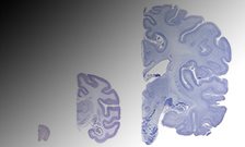 How to build a brain: discovery solves evolutionary mystery