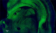 Gene-edited mice may hold key to motor neurone disease