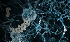 Discovery could explain failed clinical trials for Alzheimer's