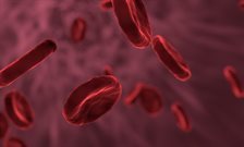 Number of people having strokes falls by 43%