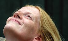 Twin research reveals which facial features are most controlled by genetics