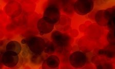 King's and Evelina collaboration awarded €2 million to tackle sickle cell disease