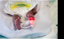 Gene related to brain damage in pre-term infants identified