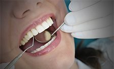 Sipping hot fruit teas can lead to tooth erosion