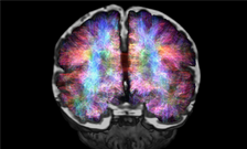Milestone Reached as 100 Participants Partake in Child Brain Research