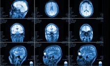 NVIDIA announce new partnership with King's to build AI Infrastructure in the Clinic