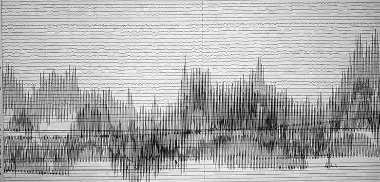 Chami, Rayane - HSDTC Science Image Competition 2019 Image
