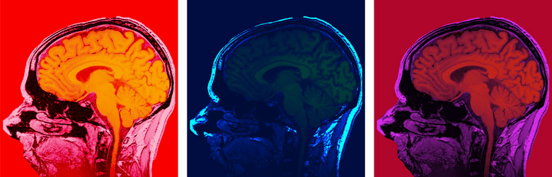 Brain strip