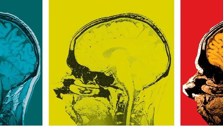 Warhol Brain v3
