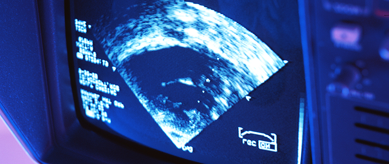 ultrasound