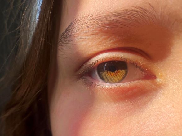 A teenage girls face, close up, showing her hazel brown eye