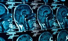 branscan image