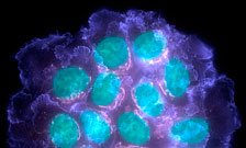 Cancer Cells