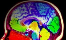 brain