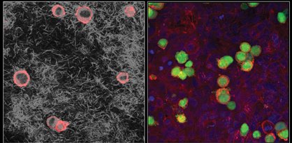 sanz_MorenoFrontPage Image1 Adhesion(418x206)
