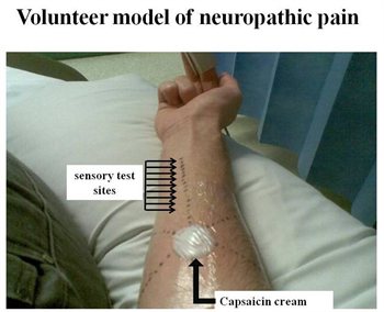 Volunteer-model