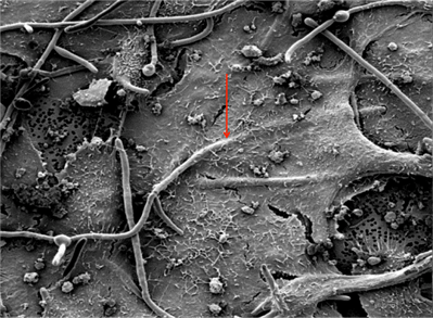 candida-albicons
