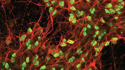 Image: Human spinal cord neurons made from human neural stem cells which, when engrafted into damaged rat spinal cord, bring about enhanced functional recovery.

©Institute of Psychiatry, Psychology & Neuroscience, King’s College London.
