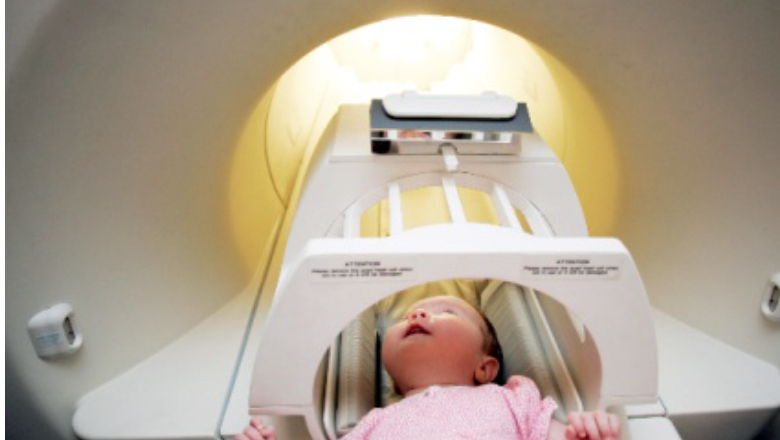 Brain Imaging in Babies (BIBS)