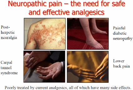Neuropathic1