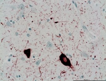 Braintissue