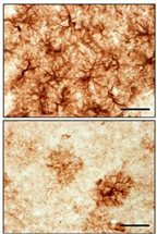 Activated astrocytes