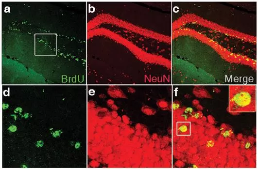 Detection of proliferation and neurogenesis in the dentate gyrus of C57BL/6 mice