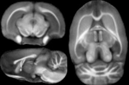 Myelin-water-fraction-map