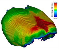 adult-rat-brain
