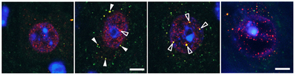 Cells-from-diseased-mice-in-article-2