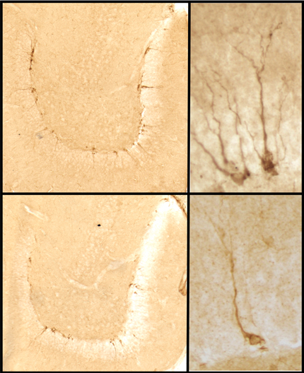 chemo-in-article