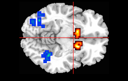 Brain scan image 430x275