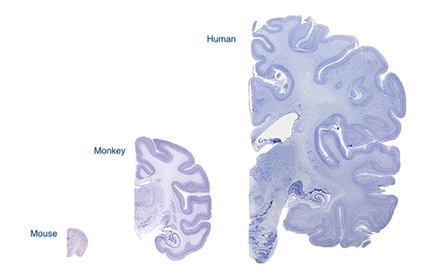 Brains430x275