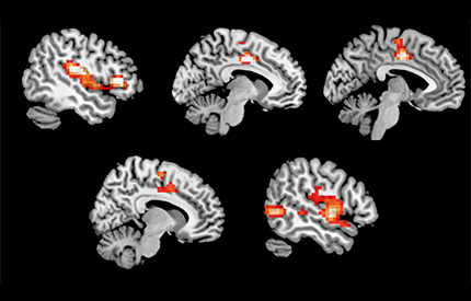 MDMA-activity-430x275